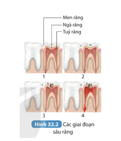 Bài 32: Dinh dưỡng và tiêu hoá ở người KHTN 8